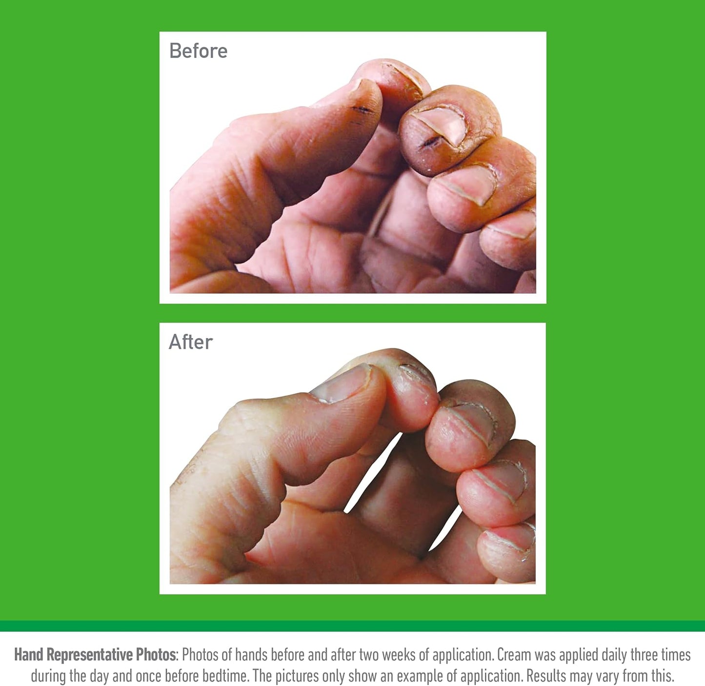 O'Keeffe's Working Hands Value Jar 193g Guaranteed Relief for Extremely Dry, Cracked Hands